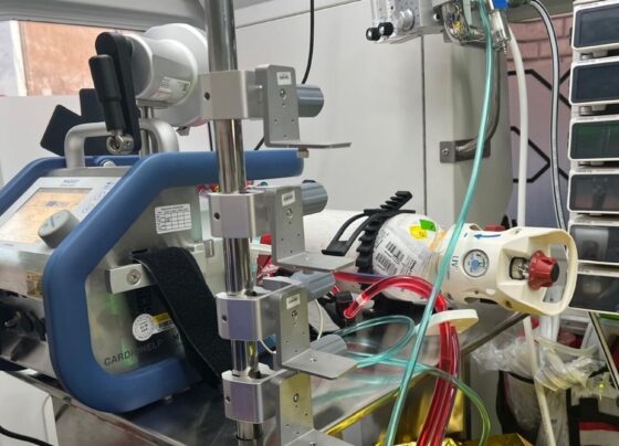 Sanità, al via il servizio Ecmo Team Mobile: di cosa si tratta