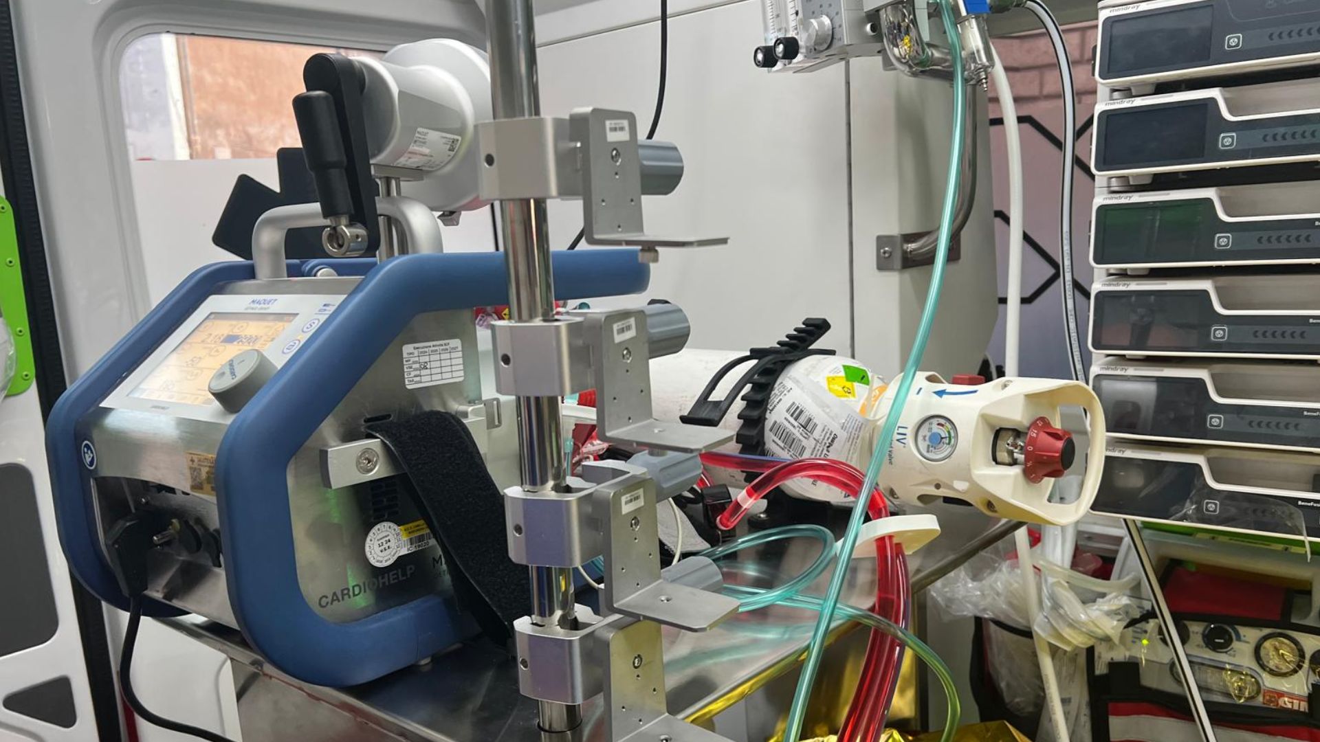 Sanità, al via il servizio Ecmo Team Mobile: di cosa si tratta